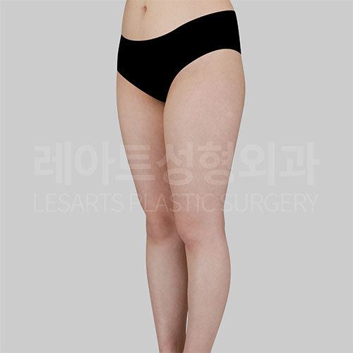 허벅지 지방흡입 반측면포스트07