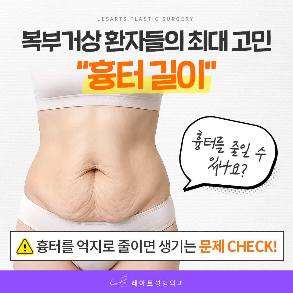 복부거상술 흉터 고민