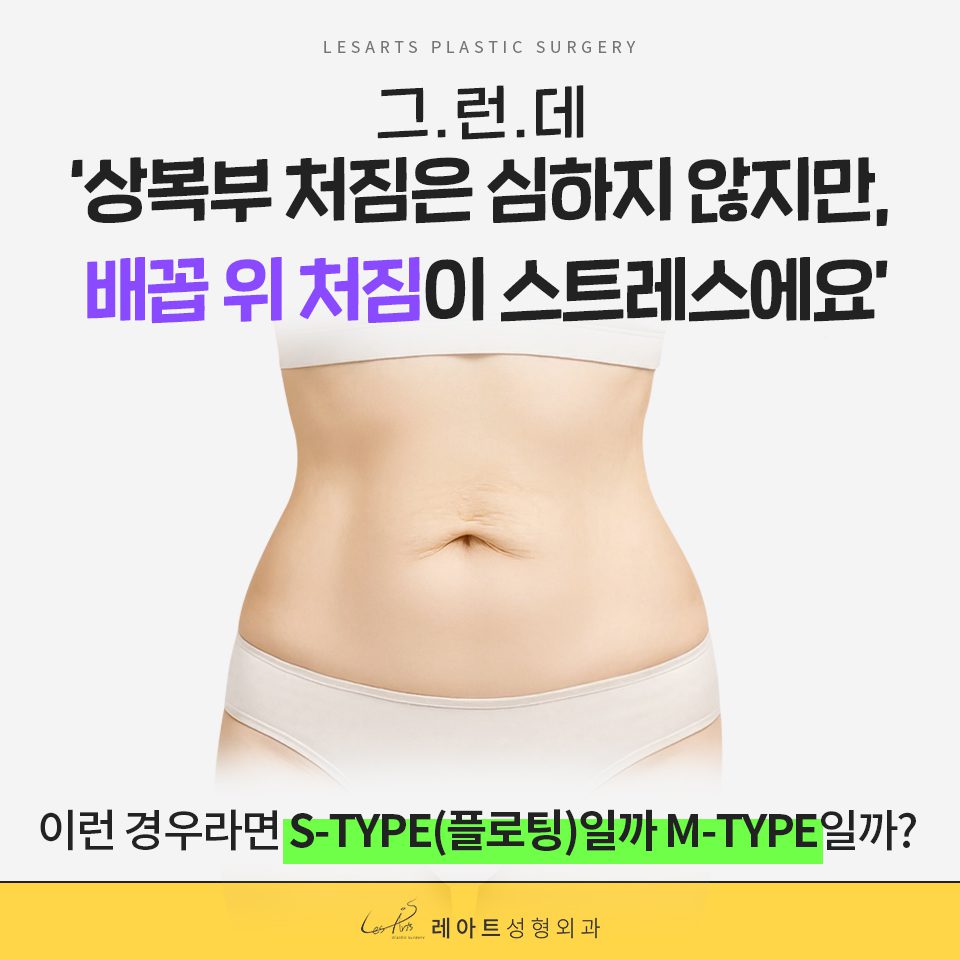 복부거상술 배꼽 위 처짐