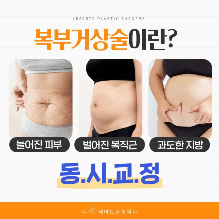 Abdominoplasty 복부거상 복부거상수술 03