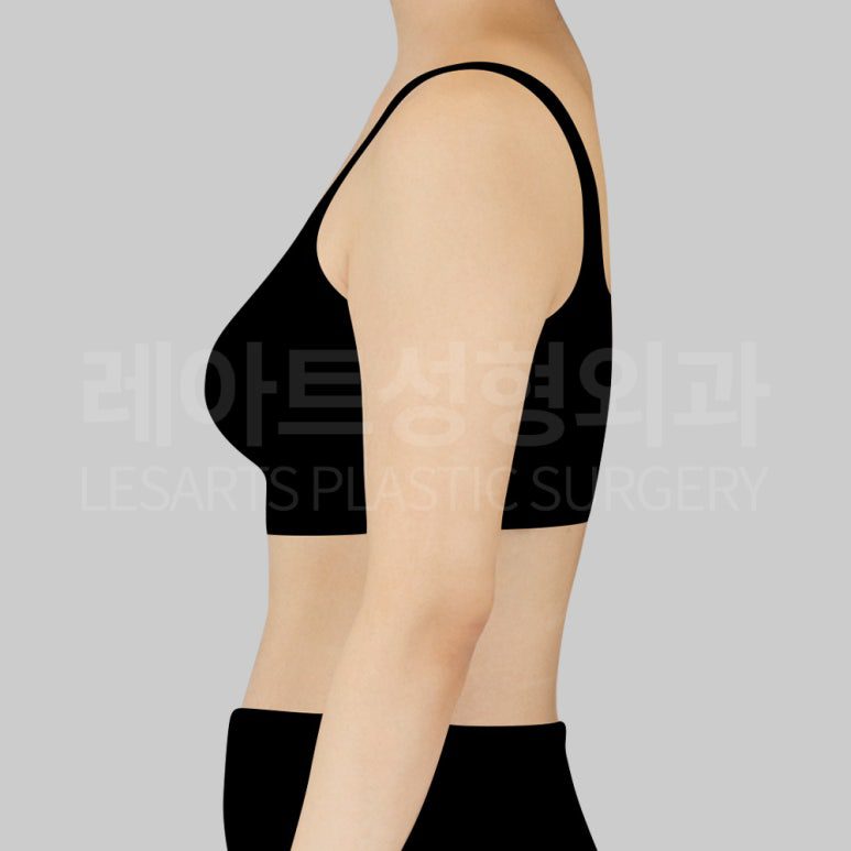 c-arm-liposuction-post17-05