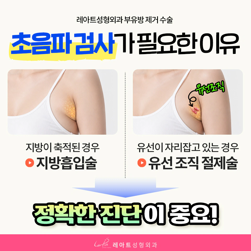 부유방 초음파 검사 - 레아트 성형외과 문지훈원장