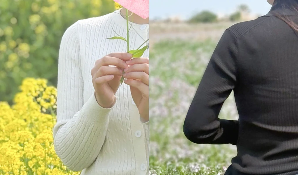 팔지방흡입 후 옷핏 - 레아트 서용승 원장