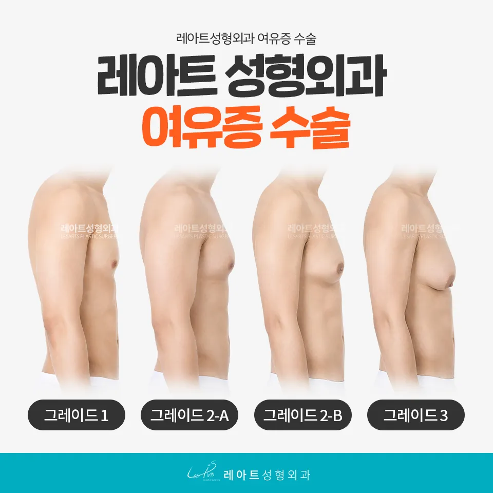여유증 증상의 외형적 진단 사이먼 그레이드