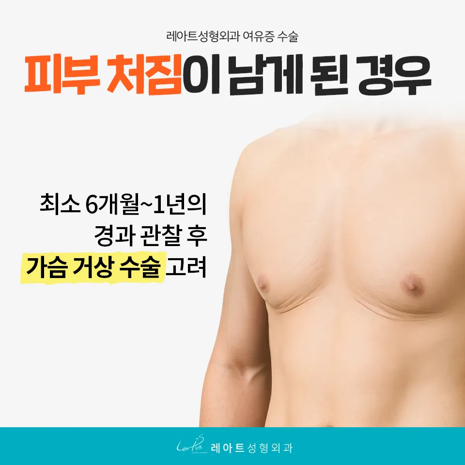 여유증 수술 후 가슴거상술