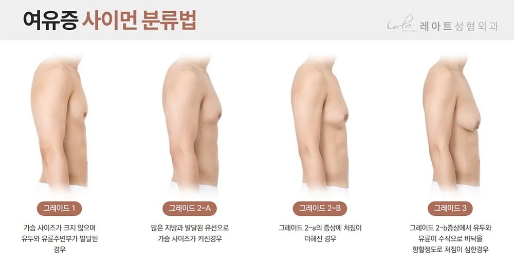 여유증 사이먼 분류법